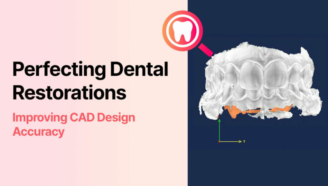 Bite-Finder: Perfecting Dental Restorations: Improving CAD Design Accuracy with Bite-Finder