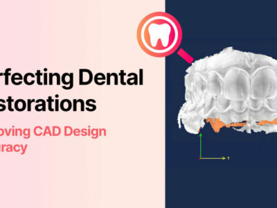 Perfecting-Dental-Restorations-Thumbnail